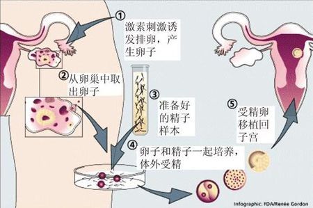 冰原生殖医学中心